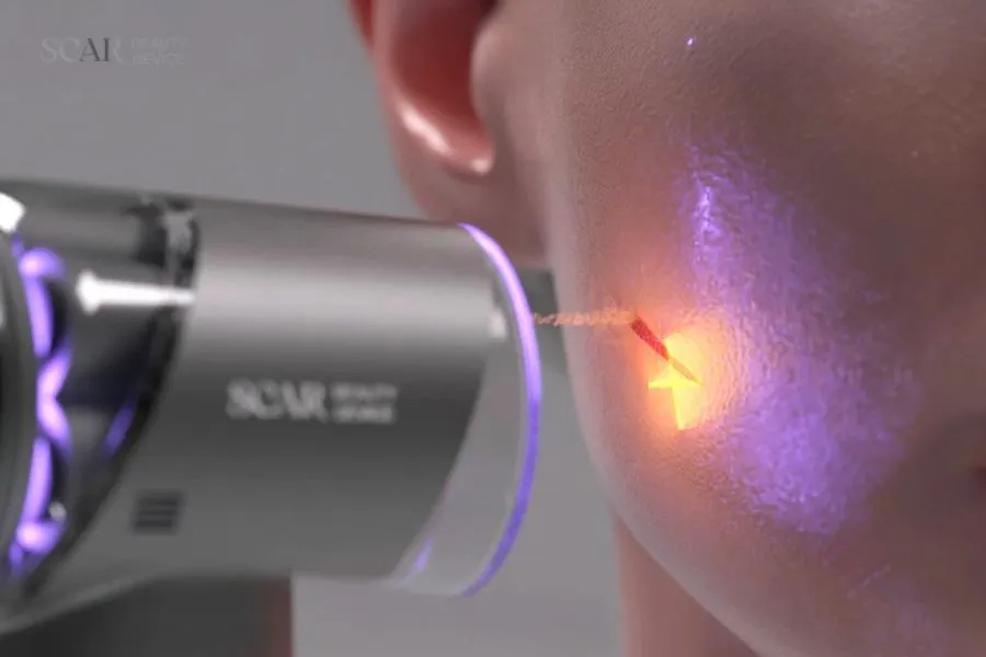 Beauty tech takeover at CES 2026: AI and smart skin care proliferate