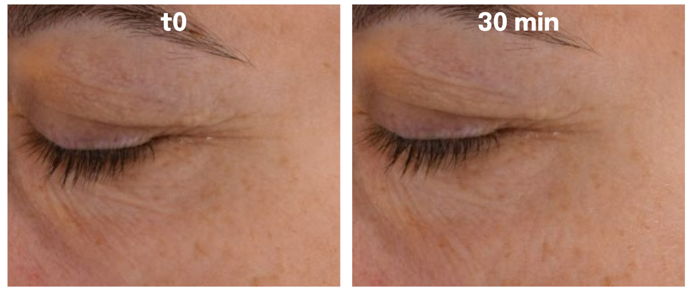 Seppic study sees “immediate” skin benefits with water-soluble polymer ...
